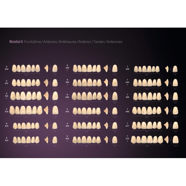 Mould Charts