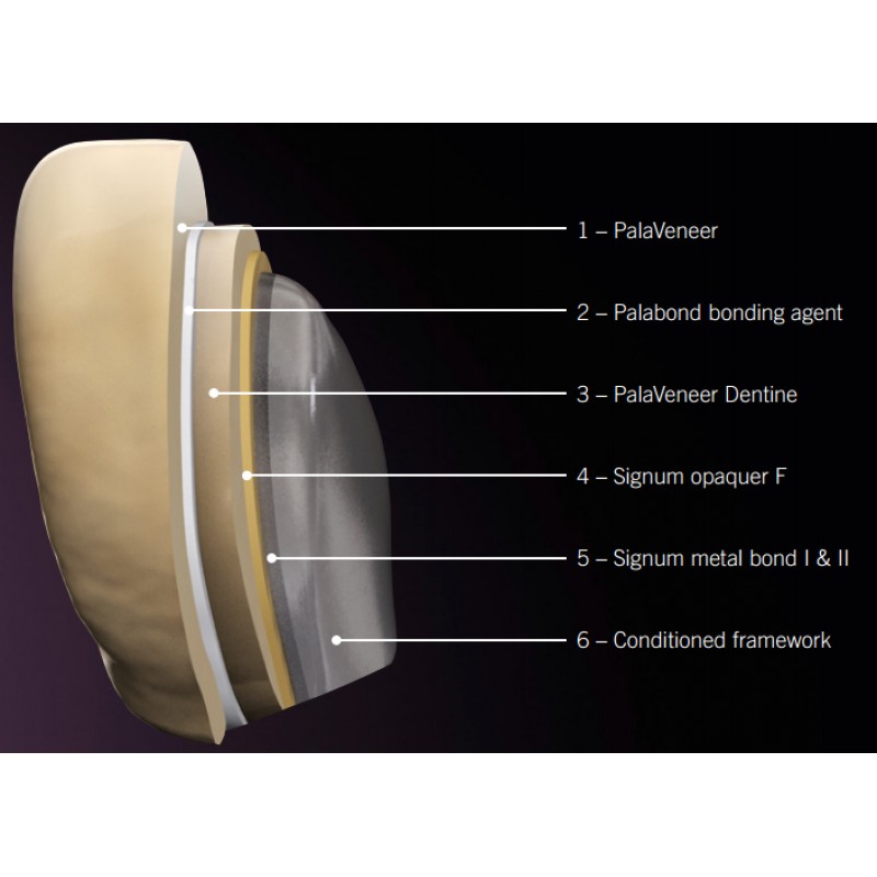 AcrylX Xthetic Temp Tooth Shade Acrylic (Crown and Bridge High