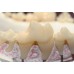 AcrylX Xthetic Temp Tooth Shade Acrylic (Crown and Bridge High Grade - Colour Stable) LIQUID ONLY 100ml