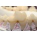 AcrylX Xthetic Temp Tooth Shade Acrylic LIQUID ONLY 100ml