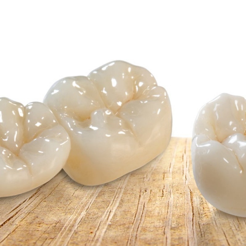 AcrylX Xthetic TEMP Tooth Shade Acrylic Starter Kit (1-608-01) - Crown and  Bridge High Grade - Colour Stable
