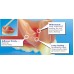 Detax Mollosil Plus - Starter Kit - Automix2  (Long Term Soft Lining Material - Self Cure) (02353) - Starter Kit