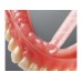 Detax Mollosil Plus - Starter Kit - Automix2  (Long Term Soft Lining Material - Self Cure) (02353) - Starter Kit