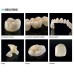 Detax Freeprint CROWN 385 DLP 3D Printing Resin - 500g