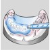 Kulzer Memosil 2 (Transparent A-silicone for special indications) 2 x 50ml - 50035018 - EVERYDAY LOW PRICE - No further discounts