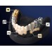 Kulzer Signum Universal Bond Set I + II - 2 x 4ml 66079923 - All In One - PEEK, Zirconium, Zirconia & Metals 