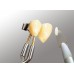 Renfert Ergo Acryl Instrument No.1 - 1 piece 10521100 ** Item maybe SPECIAL ORDER INDENT **