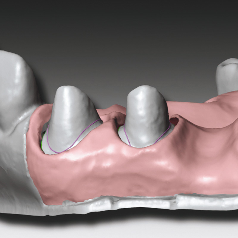 Zhermack Gingifast CAD (Gingival Mask Scannable)  - Elastic 40 Shore A - 2 x 50ml (C203227) - DG - SPECIAL OFFER - SHORT DATED STOCK EX 07/25