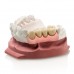 Zhermack Gingifast CAD (Gingival Mask Scannable)  - Elastic 40 Shore A - 2 x 50ml (C203227) - DG - SPECIAL OFFER - SHORT DATED STOCK EX 07/25